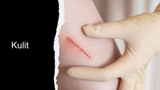 Kulit