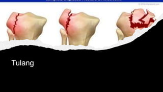 Tulang