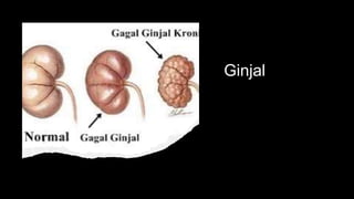 Ginjal