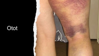 Otot