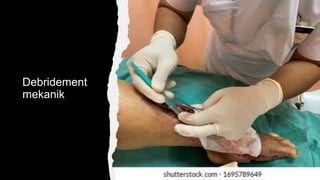 Debridement
mekanik