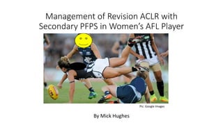 Management of Revision ACLR with
Secondary PFPS in Women’s AFL Player
By Mick Hughes
Pic: Google Images
 