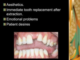 Avoidance of RPD
Poor oral hygiene
Mentally retarded patient
Patient with large tongue.
 