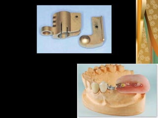 Temporary removable partial
denture
they are used in patient where tissue
changes are expected, where a permanent
prosthes...