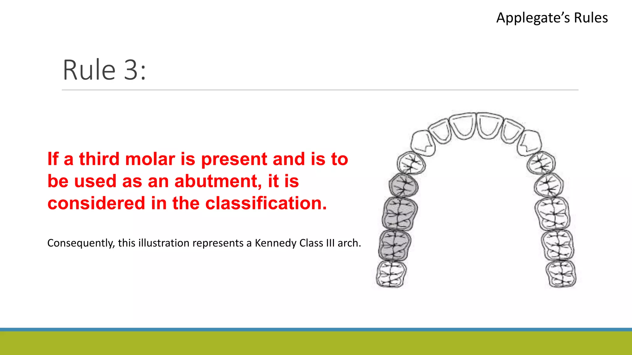 Rule 3:
Applegate’s Rules
If a third molar is present and is to
be used as an abutment, it is
considered in the classification.
Consequently, this illustration represents a Kennedy Class III arch.
 