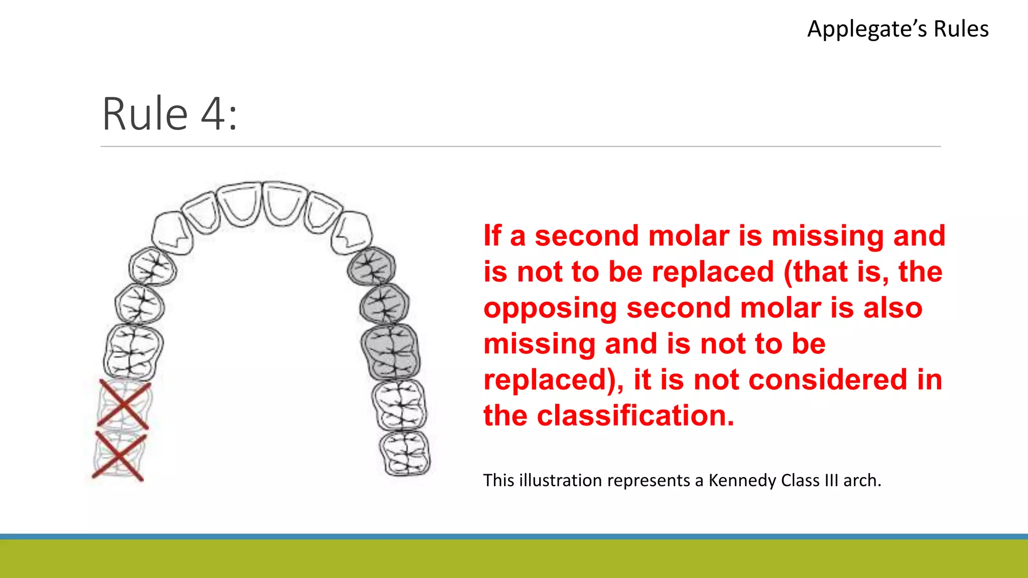 Rule 4:
Applegate’s Rules
If a second molar is missing and
is not to be replaced (that is, the
opposing second molar is also
missing and is not to be
replaced), it is not considered in
the classification.
This illustration represents a Kennedy Class III arch.
 