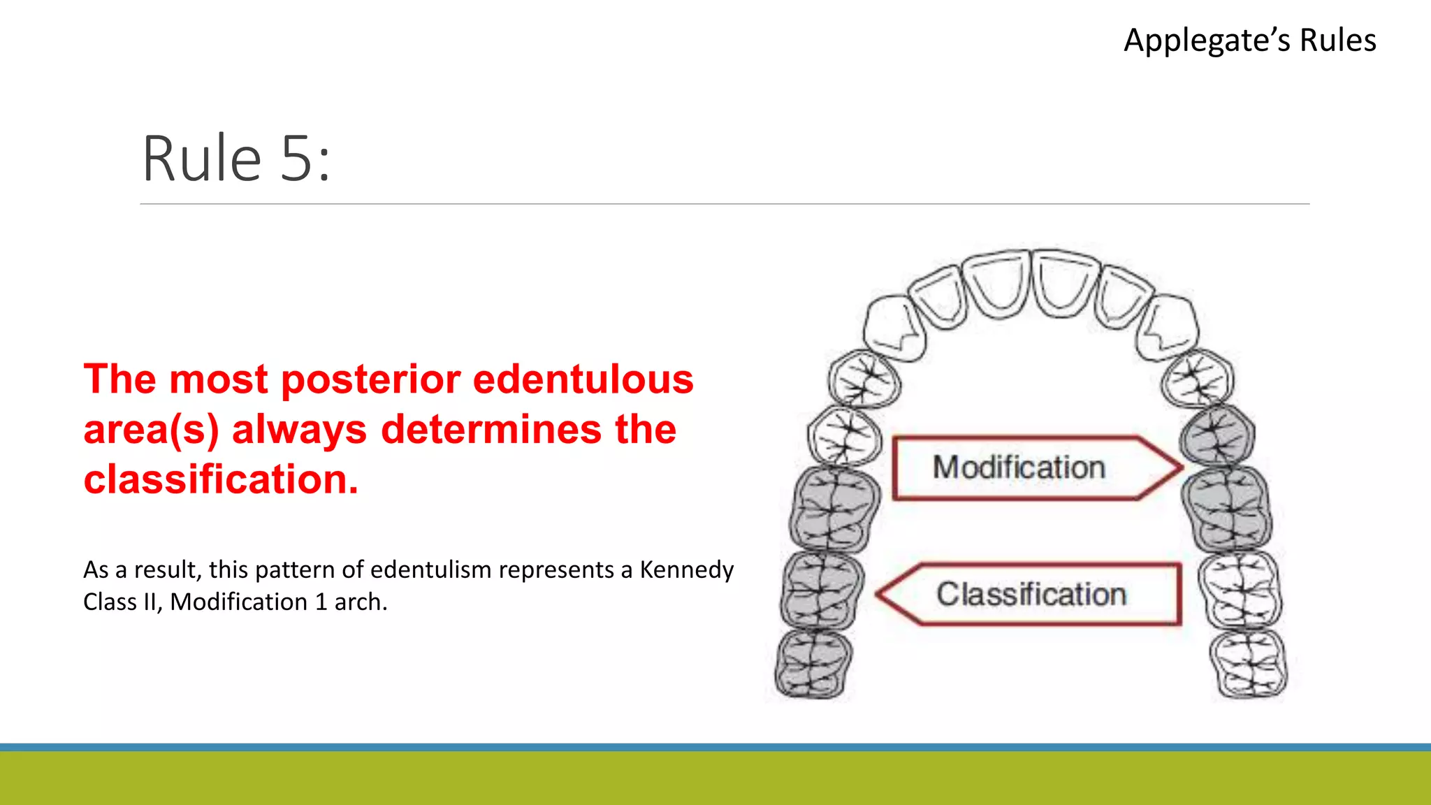 Rule 5:
Applegate’s Rules
The most posterior edentulous
area(s) always determines the
classification.
As a result, this pattern of edentulism represents a Kennedy
Class II, Modification 1 arch.
 