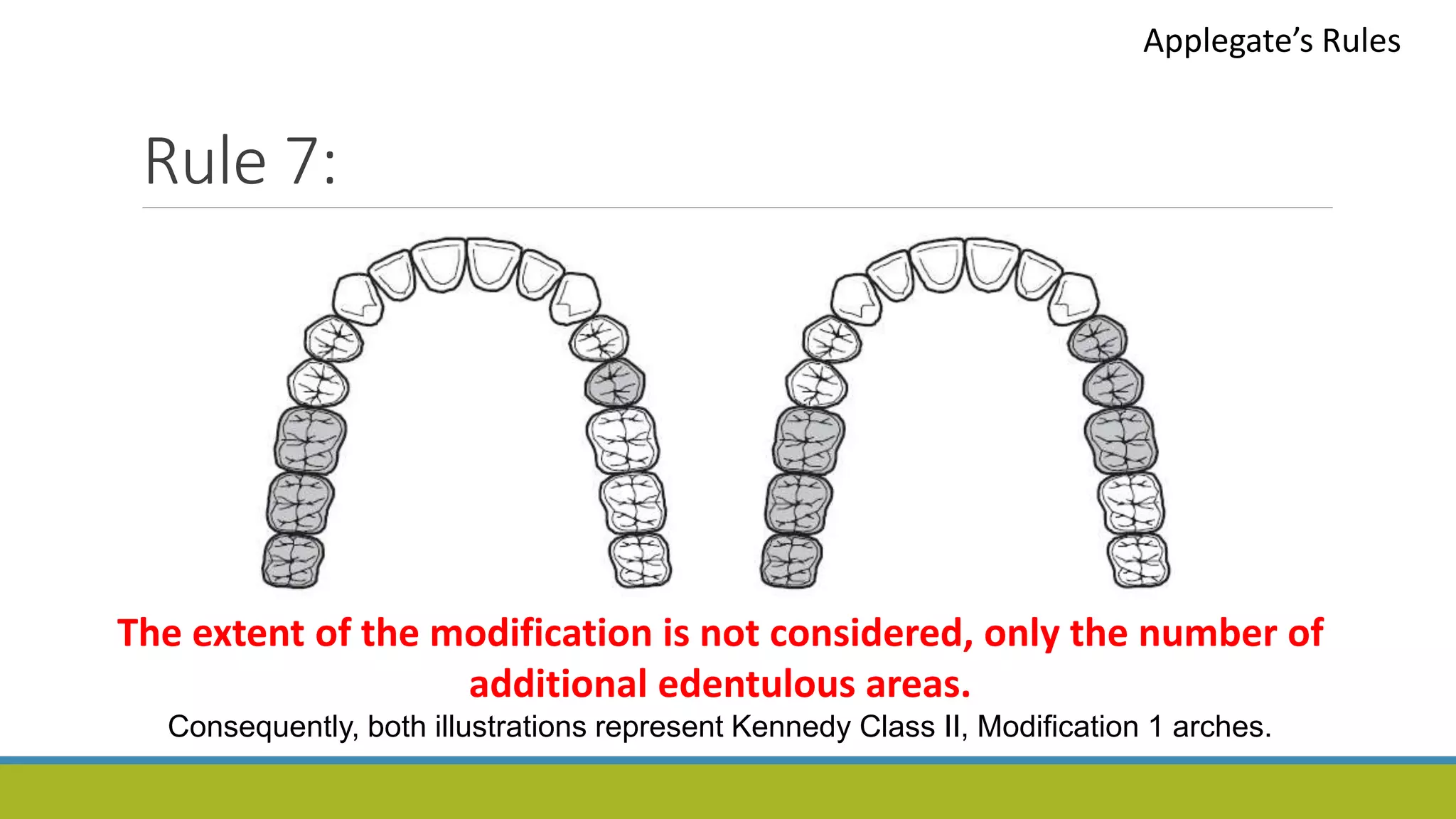 Rule 7:
Applegate’s Rules
The extent of the modification is not considered, only the number of
additional edentulous areas.
Consequently, both illustrations represent Kennedy Class II, Modification 1 arches.
 