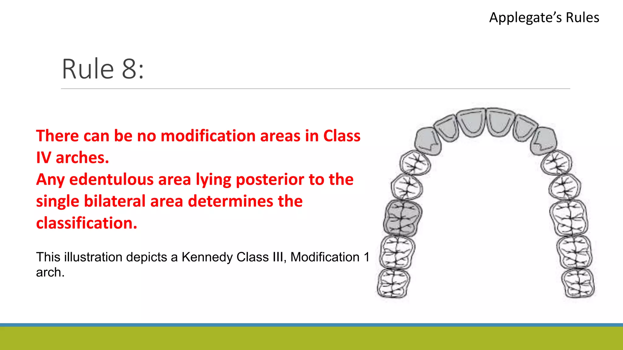 Rule 8:
Applegate’s Rules
There can be no modification areas in Class
IV arches.
Any edentulous area lying posterior to the
single bilateral area determines the
classification.
This illustration depicts a Kennedy Class III, Modification 1
arch.
 