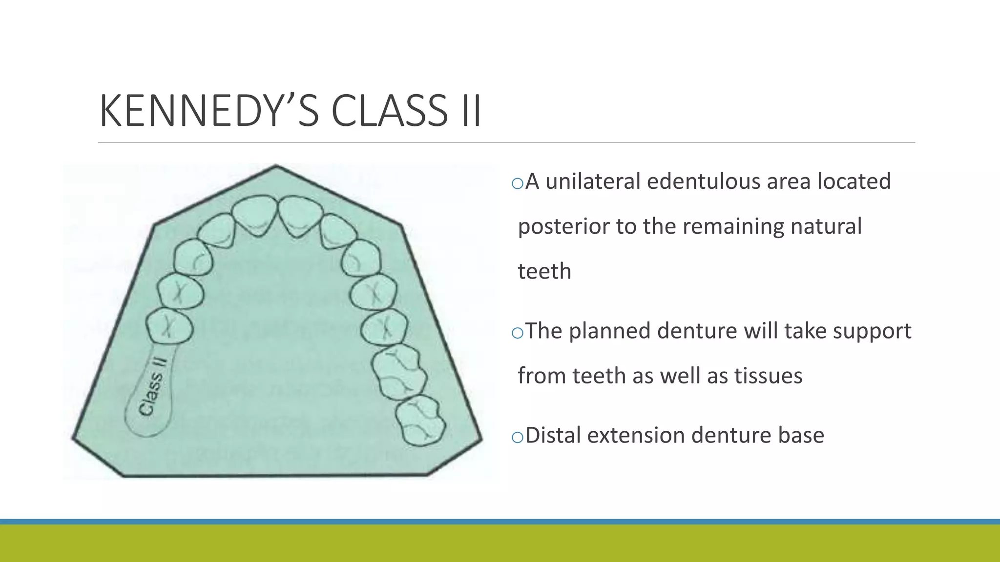 KENNEDY’S CLASS II
oA unilateral edentulous area located
posterior to the remaining natural
teeth
oThe planned denture will take support
from teeth as well as tissues
oDistal extension denture base
 
