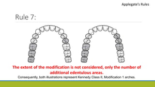 Rule 7:
Applegate’s Rules
The extent of the modification is not considered, only the number of
additional edentulous areas.
Consequently, both illustrations represent Kennedy Class II, Modification 1 arches.
 