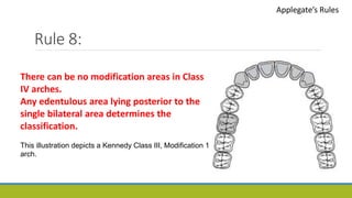 Rule 8:
Applegate’s Rules
There can be no modification areas in Class
IV arches.
Any edentulous area lying posterior to the
single bilateral area determines the
classification.
This illustration depicts a Kennedy Class III, Modification 1
arch.
 