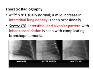 Thoracic Radiography:
• Mild ITB: Usually normal; a mild increase in
interstitial lung density is seen occasionally.
• Severe ITB: Interstitial and alveolar pattern with
lobar consolidation is seen with complicating
bronchopneumonia.
 