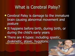 What is Cerebral Palsy? Cerebral Palsy is damage to the immature brain causing abnormal movement and posture It happens before birth, during birth, or during the child’s early years There are 4 types: including spastic, dyskinetic, ataxic, hypotonic  http://www.kianh.org.uk/pictures/tuan5.JPG 
