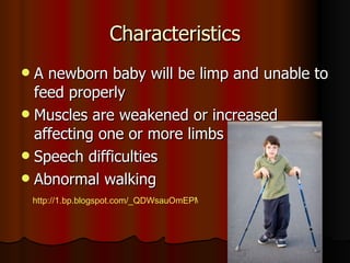 Characteristics A newborn baby will be limp and unable to feed properly  Muscles are weakened or increased affecting one or more limbs Speech difficulties Abnormal walking  http://1.bp.blogspot.com/_QDWsauOmEPM/TC4LyTI_uHI/AAAAAAAAAtc/008YAcnGavs/s1600/673270_f260.jpg 
