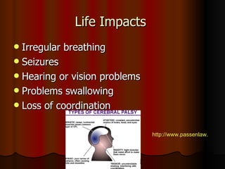 Life Impacts  Irregular breathing Seizures Hearing or vision problems Problems swallowing Loss of coordination http://www.passenlaw.com/blog/wp-content/uploads/2010/03/cerebral-palsy-types.gif 