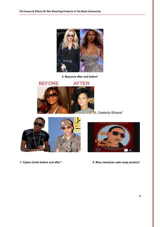 Skin Bleaching Risks Causes & Effects of Skin Bleaching Publication 30 November 2012 By ...