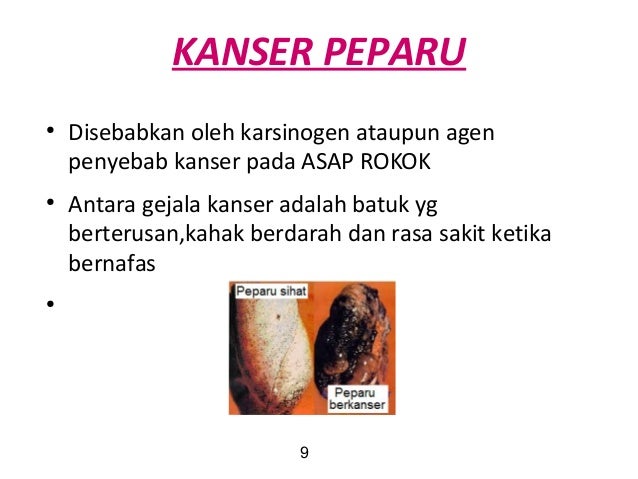 Kepentingan sistem respirasi yang sihat Kepentingan sistem respirasi yang sihat