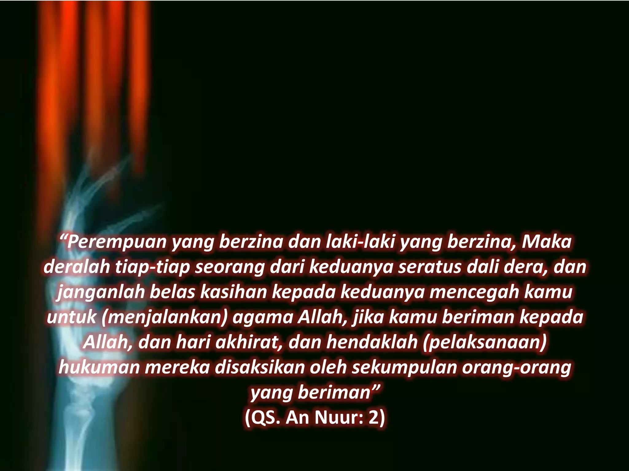 “Perempuan yang berzina dan laki-laki yang berzina, Maka
deralah tiap-tiap seorang dari keduanya seratus dali dera, dan
 janganlah belas kasihan kepada keduanya mencegah kamu
untuk (menjalankan) agama Allah, jika kamu beriman kepada
    Allah, dan hari akhirat, dan hendaklah (pelaksanaan)
 hukuman mereka disaksikan oleh sekumpulan orang-orang
                        yang beriman”
                       (QS. An Nuur: 2)
 