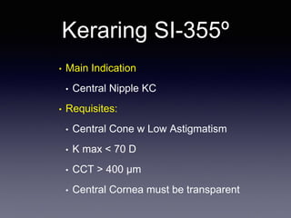 • Main Indication
• Central Nipple KC
• Requisites:
• Central Cone w Low Astigmatism
• K max < 70 D
• CCT > 400 µm
• Central Cornea must be transparent
Keraring SI-355º
 
