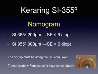 Nomogram
• SI 355º 200µm →SE ≤ 6 diopt
• SI 355º 300µm →SE > 6 diopt
Keraring SI-355º
The 5º gap must be along the incisional axis
Tunnel made w Femtosecond laser is mandatory
 