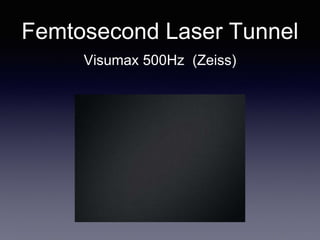 Femtosecond Laser Tunnel
Visumax 500Hz (Zeiss)
 