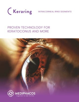 PROVEN TECHNOLOGY FOR
KERATOCONUS AND MORE
INTRACORNEAL RING SEGMENTS
 
