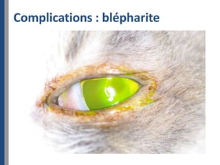 Complications : blépharite
 
