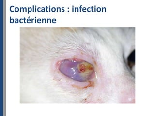 Complications : infection
bactérienne
 