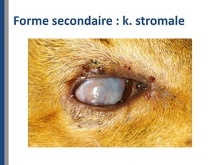Forme secondaire : k. stromale
 