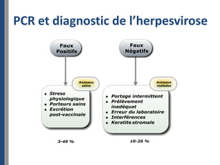 PCR et diagnostic de l’herpesvirose
 