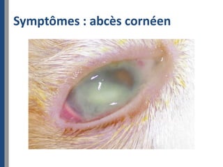 Symptômes : abcès cornéen
 