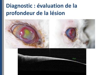 Diagnostic : évaluation de la
profondeur de la lésion
 
