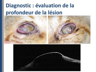 Diagnostic : évaluation de la
profondeur de la lésion
 