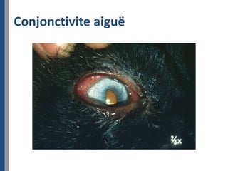 Conjonctivite aiguë
 