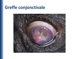 Greffe conjonctivale
 