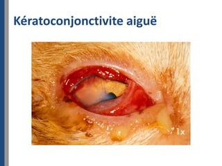 Kératoconjonctivite aiguë
 