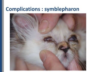 Complications : symblepharon
 