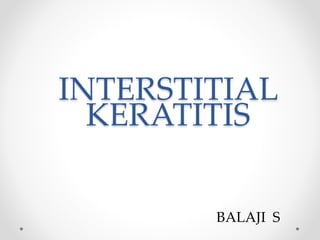 INTERSTITIAL
KERATITIS
BALAJI S
 
