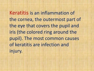 Keratitis is an inflammation of
the cornea, the outermost part of
the eye that covers the pupil and
iris (the colored ring around the
pupil). The most common causes
of keratitis are infection and
injury.