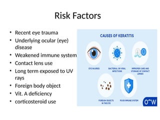 Risk Factors
• Recent eye trauma
• Underlying ocular (eye)
disease
• Weakened immune system
• Contact lens use
• Long term exposed to UV
rays
• Foreign body object
• Vit. A deficiency
• corticosteroid use
 