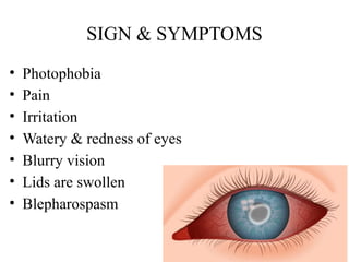 SIGN & SYMPTOMS
• Photophobia
• Pain
• Irritation
• Watery & redness of eyes
• Blurry vision
• Lids are swollen
• Blepharospasm
 