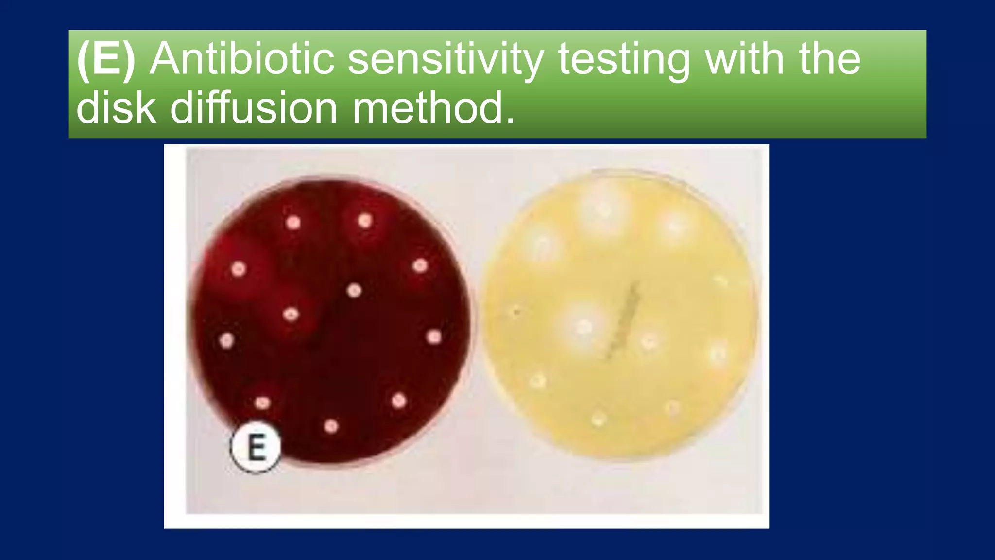 (E) Antibiotic sensitivity testing with the
disk diffusion method.
 