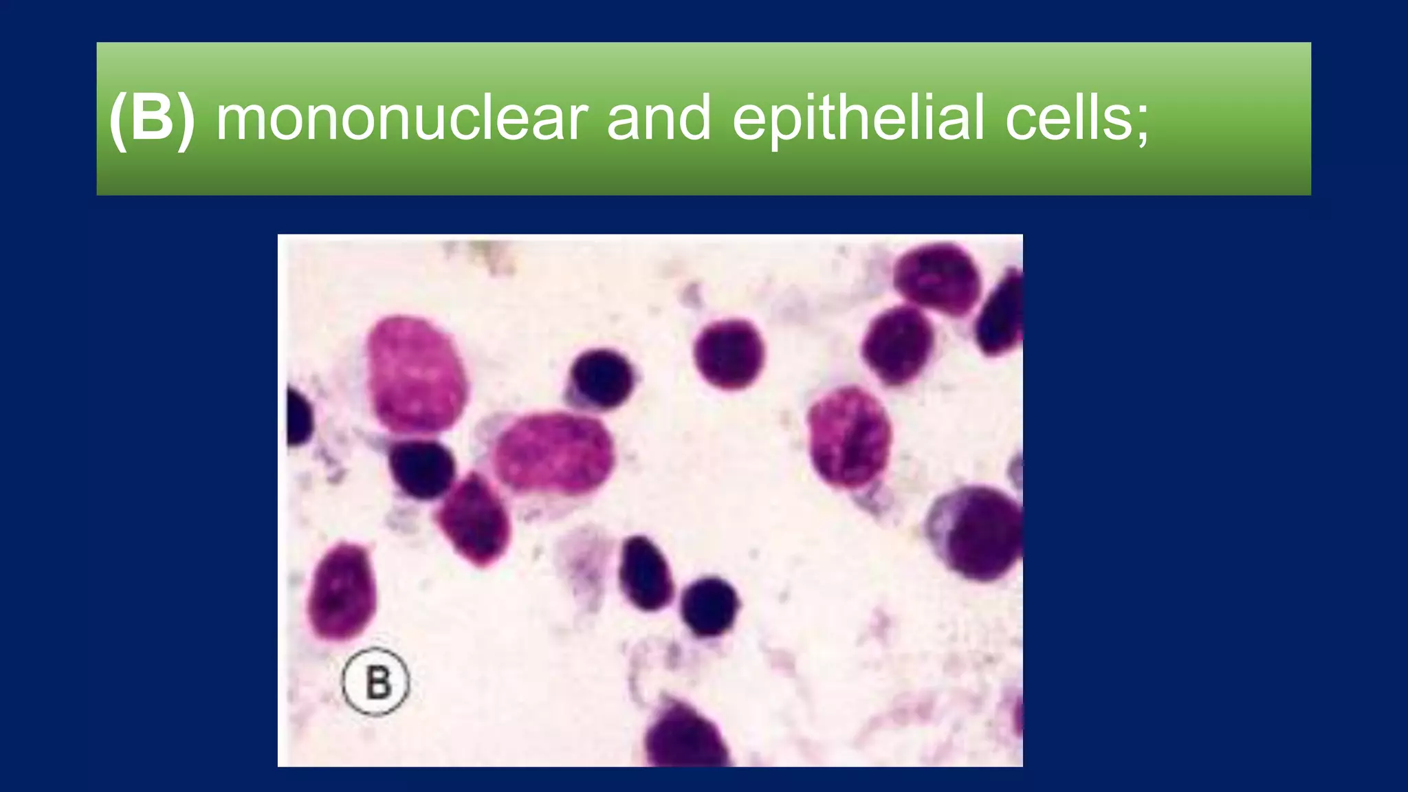 (B) mononuclear and epithelial cells;
 