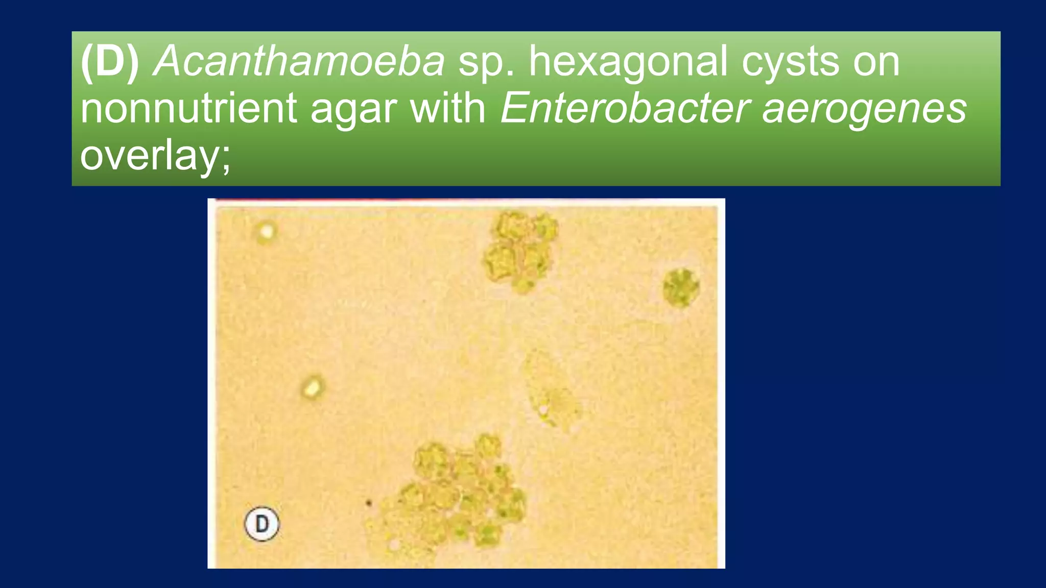 (D) Acanthamoeba sp. hexagonal cysts on
nonnutrient agar with Enterobacter aerogenes
overlay;
 
