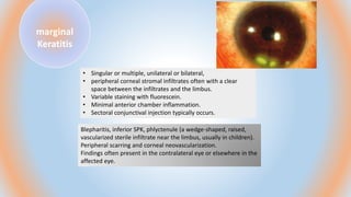 keratitis [Autosaved].pptx