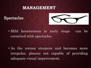 Spectacles
• Mild keratoconus in early stage can be
corrected with spectacles.
• As the cornea steepens and becomes more
irregular, glasses not capable of providing
adequate visual improvement.
MANAGEMENT
 