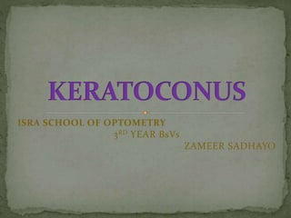 ISRA SCHOOL OF OPTOMETRY
3RD YEAR BsVs
ZAMEER SADHAYO
 