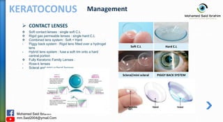 Piggyback Rgp Keratoconus القرنية المخروطية | PPTX