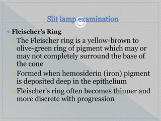  Fleischer's Ring
The Fleischer ring is a yellow-brown to
olive-green ring of pigment which may or
may not completely surround the base of
the cone
Formed when hemosiderin (iron) pigment
is deposited deep in the epithelium
Fleischer's ring often becomes thinner and
more discrete with progression
 